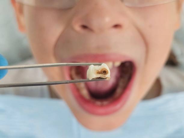Best Emergency Dental Care for Trauma or Injury in Lexington, IL